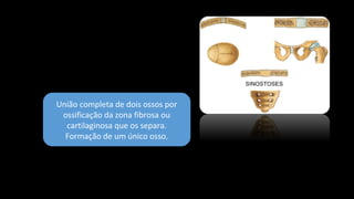 União completa de dois ossos por
ossificação da zona fibrosa ou
cartilaginosa que os separa.
Formação de um único osso.
 