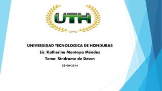 UNIVERSIDAD TECNOLOGICA DE HONDURAS
Lic. Katherine Montoya Méndez
Tema: Síndrome de Down
03-08-2014
 