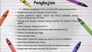 Pengkajian
1. Lakukan pengkajian fisik, karakteristik yang sering terlihat :
• Tengkorak bulat kecil dengan oksiput datar
• Lipatan epikantus bagian dalam dan fisura palbebra serong
(mata miring ke atas, ke luar)
• Hidung kecil dengan batang hidung tertekan ke bawah (hidung
sadel)
• Lidah menjulur kadang berfisura
• Mandibula hipoplastik (membuat lidah tampak besar)
• Palatum berlengkung tinggi
• Leher pendek tebal
• Muskulatur hipotonik (abdomen buncit, hernia umbilikus)
• Sendi hiperfleksibel dan lemas
• Garis simian (puncak tranversal pada sisi telapak tangan)
• Tangan dan kaki lebar, pendek dan tumpul.
 
