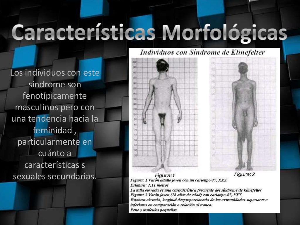 Características Da Síndrome De Klinefelter Edubrainaz