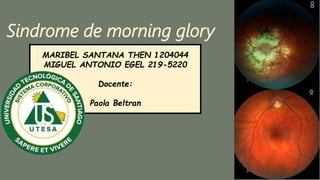 Sindrome de morning glory
MARIBEL SANTANA THEN 1204044
MIGUEL ANTONIO EGEL 219-5220
Docente:
Paola Beltran
 
