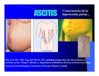 Sindrome Ascitico Edematoso