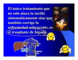 Sindrome Ascitico Edematoso