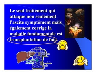 Sindrome Ascitico Edematoso