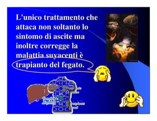 Sindrome Ascitico Edematoso