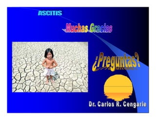 Sindrome Ascitico Edematoso