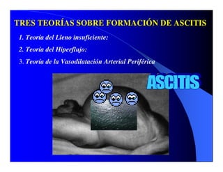 Sindrome Ascitico Edematoso