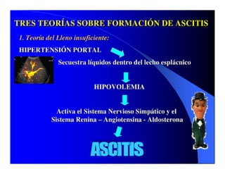 Sindrome Ascitico Edematoso
