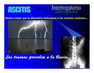 Sindrome Ascitico Edematoso