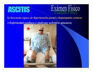 Sindrome Ascitico Edematoso