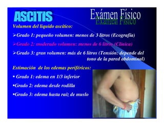 Sindrome Ascitico Edematoso