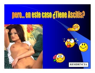 Sindrome Ascitico Edematoso