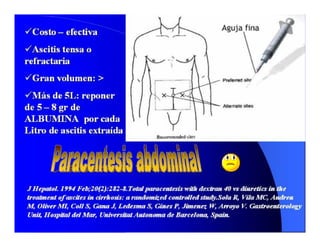 Sindrome Ascitico Edematoso