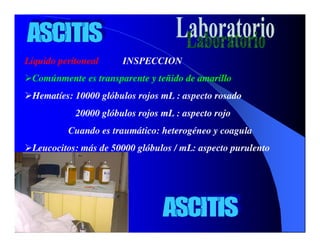 Sindrome Ascitico Edematoso