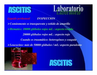 Sindrome Ascitico Edematoso