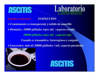 Sindrome Ascitico Edematoso