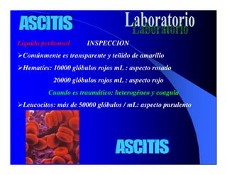 Sindrome Ascitico Edematoso