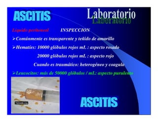 Sindrome Ascitico Edematoso