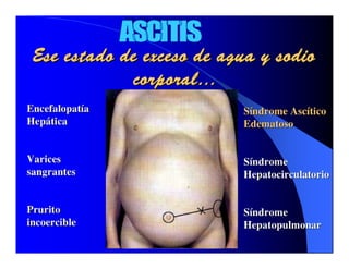 Sindrome Ascitico Edematoso