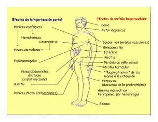 Sindrome Ascitico Edematoso