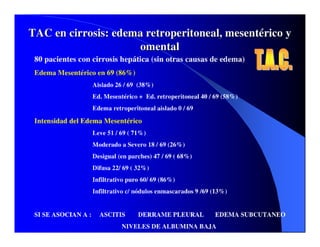 Sindrome Ascitico Edematoso