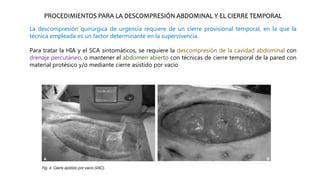 PROCEDIMIENTOS PARA LA DESCOMPRESIÓN ABDOMINAL Y EL CIERRE TEMPORAL
La descompresión quirúrgica de urgencia requiere de un cierre provisional temporal, en la que la
técnica empleada es un factor determinante en la supervivencia.
Para tratar la HIA y el SCA sintomáticos, se requiere la descompresión de la cavidad abdominal con
drenaje percutáneo, o mantener el abdomen abierto con técnicas de cierre temporal de la pared con
material protésico y/o mediante cierre asistido por vacío.
 