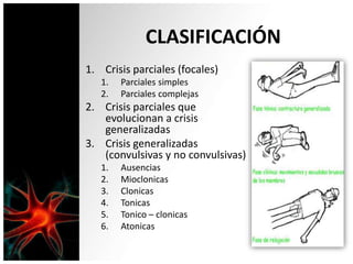 CLASIFICACIÓN
1. Crisis parciales (focales)
1. Parciales simples
2. Parciales complejas
2. Crisis parciales que
evolucionan a crisis
generalizadas
3. Crisis generalizadas
(convulsivas y no convulsivas)
1. Ausencias
2. Mioclonicas
3. Clonicas
4. Tonicas
5. Tonico – clonicas
6. Atonicas
 