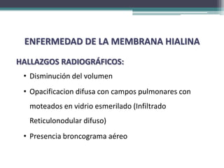 ENFERMEDAD DE LA MEMBRANA HIALINA

HALLAZGOS RADIOGRÁFICOS:
 • Disminución del volumen
 • Opacificacion difusa con campos pulmonares con
  moteados en vidrio esmerilado (Infiltrado
  Reticulonodular difuso)
 • Presencia broncograma aéreo
 