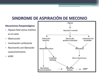SINDROME DE ASPIRACIÓN DE MECONIO
Mecanismos fisiopatológicos
• Hipoxia fetal activa motilina
  en el colon
• Obstrucción
• Inactivación surfactante
• Neumonitis con liberación
  vasoconstrictores
• HTPP
 