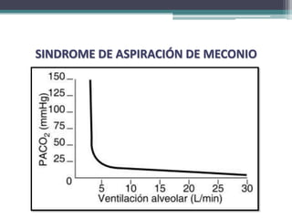 SINDROME DE ASPIRACIÓN DE MECONIO
 