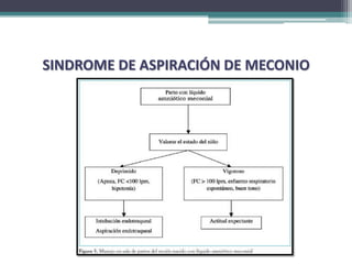 SINDROME DE ASPIRACIÓN DE MECONIO
 
