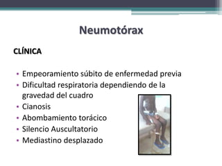 Neumotórax
CLÍNICA

• Empeoramiento súbito de enfermedad previa
• Dificultad respiratoria dependiendo de la
  gravedad del cuadro
• Cianosis
• Abombamiento torácico
• Silencio Auscultatorio
• Mediastino desplazado
 