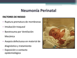 Neumonía Perinatal
FACTORES DE RIESGO
• Ruptura prematura de membranas
• Intubación traqueal
• Barotrauma por Ventilación
  Mecánica
• Asepsia defectuosa en material de
  diagnóstico y tratamiento
• Exposición o contacto
  epidemiológico
 