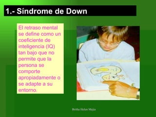 1.- Síndrome de Down El retraso mental se define como un coeficiente de inteligencia (IQ) tan bajo que no permite que la persona se comporte apropiadamente o se adapte a su entorno .  