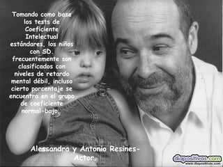 Alessandra y Antonio Resines-Actor. Tomando como base los tests de Coeficiente Intelectual estándares, los niños con SD. frecuentemente son clasificados con niveles de retardo mental débil, incluso cierto porcentaje se encuentra en el grupo de coeficiente normal-bajo.   