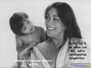 Carmen y Carmen Maura-Actriz. El 40-50 % de niños con SD, sufre cardiopatías congénitas.   