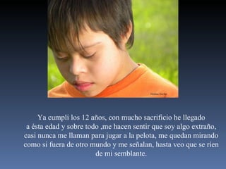 Ya cumpli los 12 años, con mucho sacrificio he llegado a ésta edad y sobre todo ,me hacen sentir que soy algo extraño, casi nunca me llaman para jugar a la pelota, me quedan mirando como si fuera de otro mundo y me señalan, hasta veo que se ríen de mi semblante. 