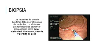 BIOPSIA
Las muestras de biopsia
duodenal deben ser obtenidas
de pacientes con síntomas
gastrointestinales atípicos o
inespecíficos como dolor
abdominal, hinchazón, anemia
y pérdida de peso
 