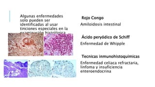 Algunas enfermedades
solo pueden ser
identificadas al usar
tinciones especiales en la
examinación histológica
Rojo Congo
Amiloidosis intestinal
Ácido peryódico de Schiff
Enfermedad de Whipple
Tecnicas inmunohistoquimicas
Enfermedad celiaca refractaria,
linfoma y insuficiencia
enteroendocrina
 