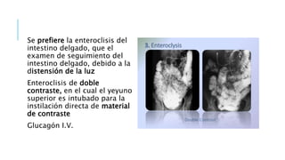Se prefiere la enteroclisis del
intestino delgado, que el
examen de seguimiento del
intestino delgado, debido a la
distensión de la luz
Enteroclisis de doble
contraste, en el cual el yeyuno
superior es intubado para la
instilación directa de material
de contraste
Glucagón I.V.
 