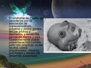 El síndrome de Pfeiffer se caracteriza por la asociación de craneosinostosis, pulgares y dedos gordos del pie anchos y desviados, y sindactilia parcial en manos y pies. Ocasionalmente puede presentarse hidrocefalia, junto con proptosis ocular severa, codos anquilosados, vísceras anormales y retraso del desarrollo psicomotor.  