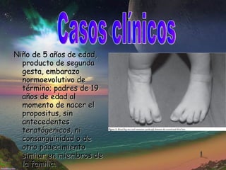 Niño de 5 años de edad, producto de segunda gesta, embarazo normoevolutivo de término; padres de 19 años de edad al momento de nacer el propositus, sin antecedentes teratógenicos, ni consanguinidad o de otro padecimiento similar en miembros de la familia.  Casos clínicos 