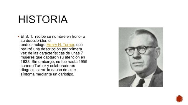 Sindrome de-turner-exposicion (1)