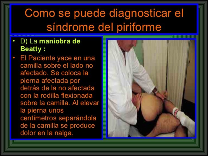 La osteocondrosis intercostal los síntomas