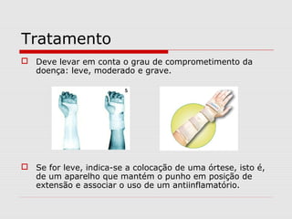 Tratamento
 Deve levar em conta o grau de comprometimento da
doença: leve, moderado e grave.
 Se for leve, indica-se a colocação de uma órtese, isto é,
de um aparelho que mantém o punho em posição de
extensão e associar o uso de um antiinflamatório.
 