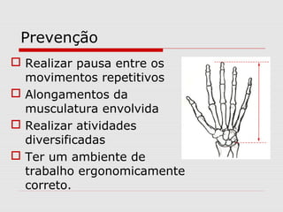 Prevenção
 Realizar pausa entre os
movimentos repetitivos
 Alongamentos da
musculatura envolvida
 Realizar atividades
diversificadas
 Ter um ambiente de
trabalho ergonomicamente
correto.
 