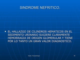 SINDROME NEFRITICO. EL HALLAZGO DE CILINDROS HEMATICOS EN EL SEDIMENTO URINARIO SUGIERE CLARAMENTE HEMORRAGIA DE ORIGEN GLOMERULAR Y TIENE POR LO TANTO UN GRAN VALOR DIAGNOSTICO. 
