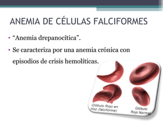 ANEMIA DE CÉLULAS FALCIFORMES
• “Anemia drepanocítica”.
• Se caracteriza por una anemia crónica con
episodios de crisis hemolíticas.
 