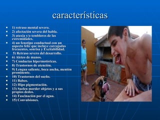 características 1) retraso mental severo. 2) afectación severa del habla. 3) ataxia y/o temblores de las extremidades. 4) un fenotipo conductual con un aspecto feliz que incluye carcajadas frecuentes, sonrisa y Excitabilidad. 5) Retraso severo del desarrollo. 6) Aleteo de manos. 7) Conductas hipermotóricas. 8) Trastornos de atención. 9) Lengua saliente, boca ancha, mentón prominente. 10) Trastornos del sueño. 11) Babeo. 12) Hipo pigmentación. 13) Suelen morder objetos y a sus propios dedos. 14) Fascinación por el agua.  15) Convulsiones. 
