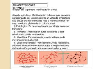 MANIFESTACIONES
CUTANEA
-Suelen ser la primera manifestación clínica
-Livedo reticularis: Manifestacion cutanea mas frecuente,
caracterizada por la aparición de un vateado amoratado
que dibuja una red de mallas mas o menos amplias en
cuyo interior la piel es de un color normal
1.-Fisiologica: Es desencadenada por el frio, suele ser
transitoria
2.- Primaria: Presenta un curso fluctuante y esta
relacionado con la temperatura
3.- Idiopática: Es persistente y suele tratarse en la
mayoría de los pacientes
4.- Livedo Racemosa: Variedad de Livedo Reticularis,
adquiere el aspecto de círculos rotos e irregulares y es
de localización generalizada en extremidades y tronco
 